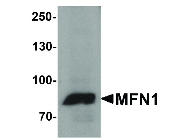 Anti-MFN1
