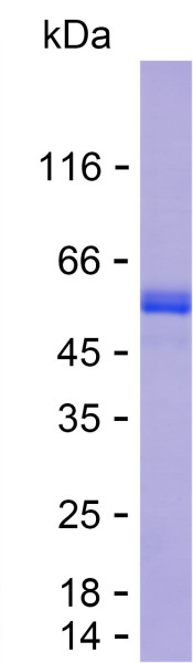 Recombinant Human TADA2A Protein