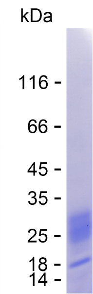 Recombinant Human DPP3 Protein