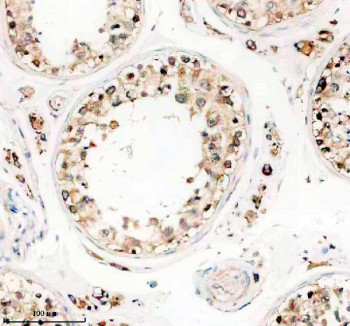Anti-TTLL1 / Tubulin-tyrosine ligase-like protein 1