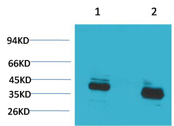 Anti-CABP