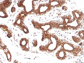 Anti-Calpastatin, clone CAST/1550