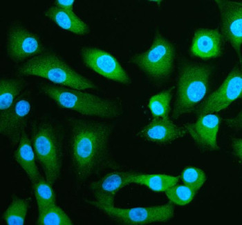Anti-SPRED1 / Sprouty-related EVH1 domain-containing protein 1
