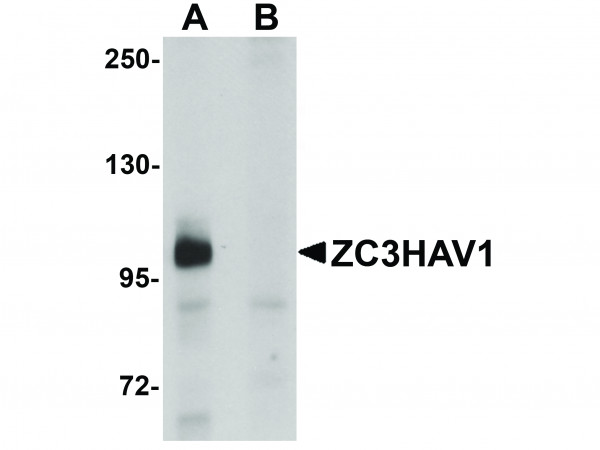 Anti-ZC3HAV1