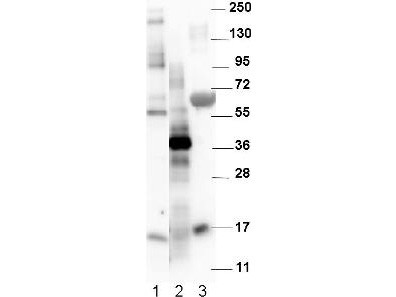 Anti-NAG-1