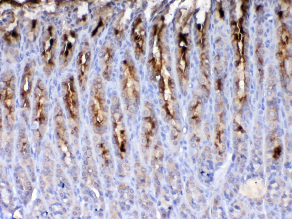 Anti-TFF2 / Spasmolytic Polypeptide