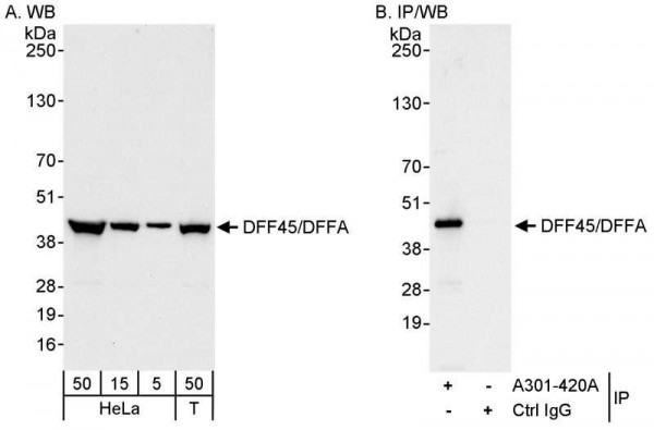 Anti-DFF45/DFFA