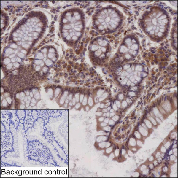 Anti-ZNF252P-AS1