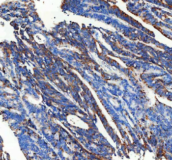 Anti-CPT2 / Carnitine O-palmitoyltransferase 2