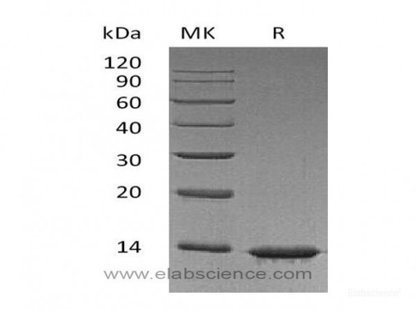 Leptin Protein (recombinant human)