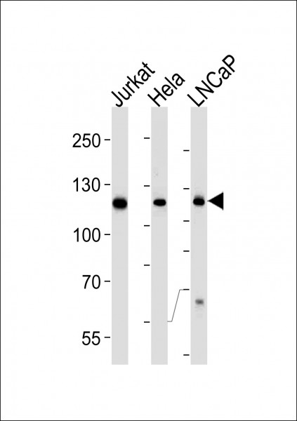 Anti-USP11, clone 1220CT620.193.189