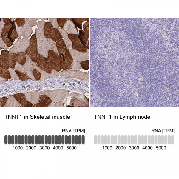 Anti-TNNT1