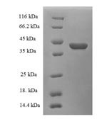 Cellular retinoic acid-binding protein 1 (CRABP1), human, recombinant