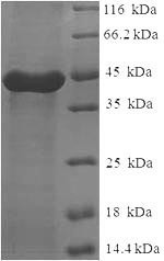 Calpain small subunit 1 (CAPNS1), human, recombinant