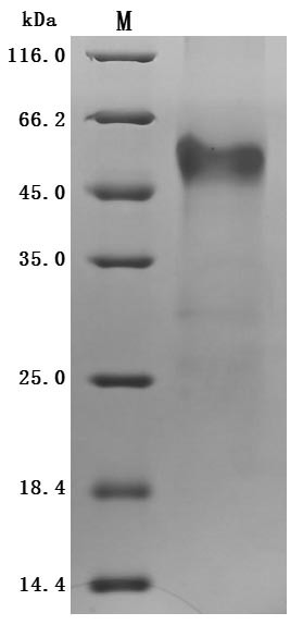 IGF-like family receptor 1 (IGFLR1), partial (Active), human, recombinant