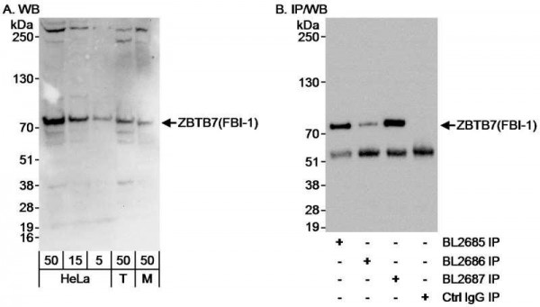 Anti-ZBTB7/FBI-1