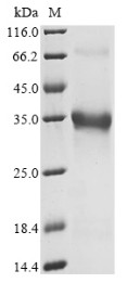 Pro-neuropeptide Y (Npy), partial, mouse, recombinant