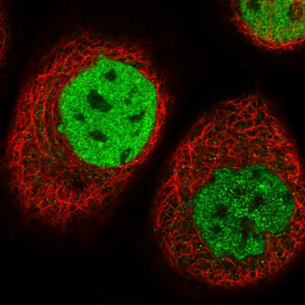 Anti-TESK2