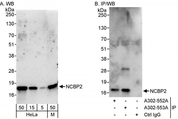 Anti-NCBP2