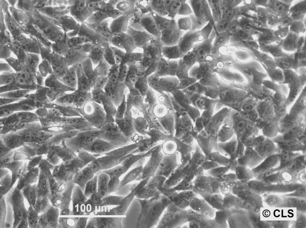 MNNG-HOS (CL #5) Cells