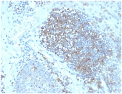 Anti-Fas Ligand (FASLG), clone FASLG/4456