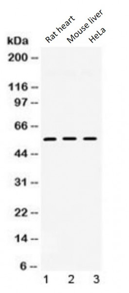 Anti-TGF beta Receptor 1