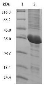 Interleukin-2 (IL2), Macaca mulatta, recombinant