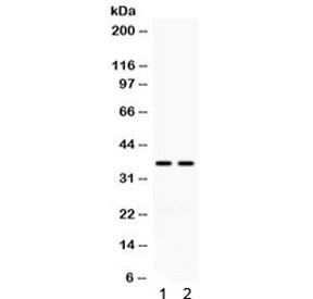 Anti-CD58 / LFA3