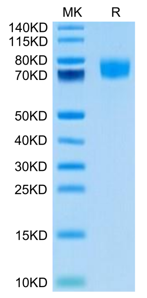 Biotinylated Human ALCAM/CD166 Protein (Primary Amine Labeling)