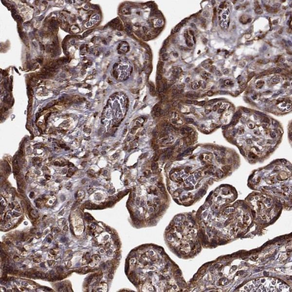 Anti-FSTL1