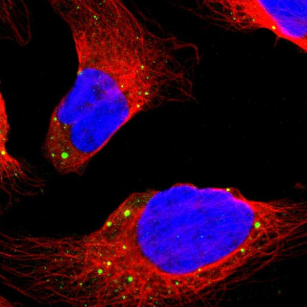 Anti-DCP1A