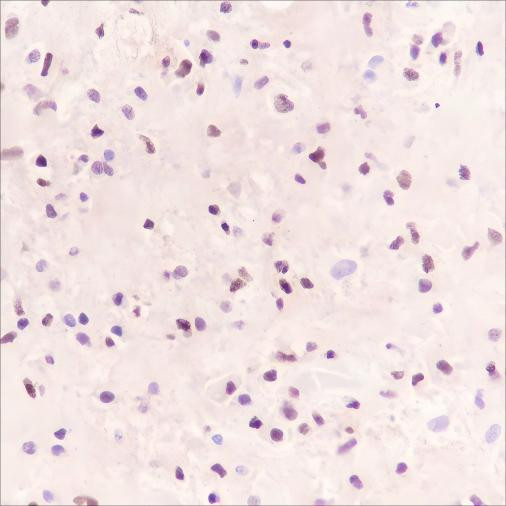 Anti-Recombinant SOX11, clone A364