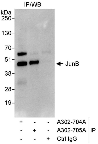 Anti-JunB