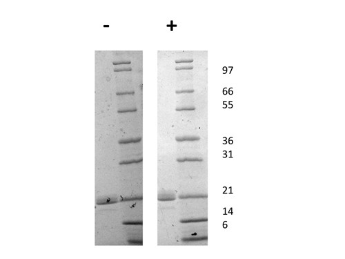 Interleukin-11