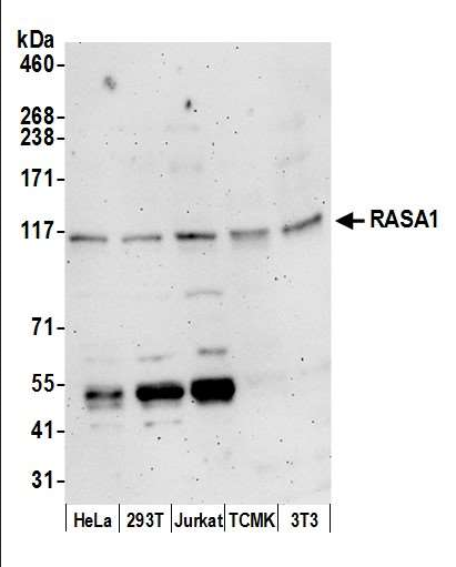 Anti-RASA1