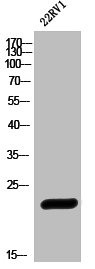Anti-HSPB1