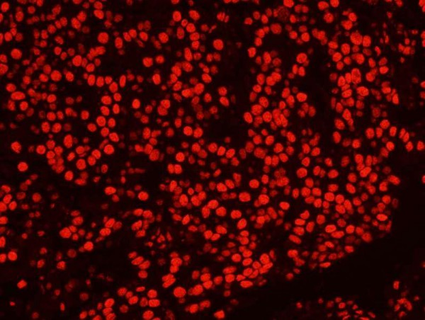 Anti-PSF/SFPQ (IHC)