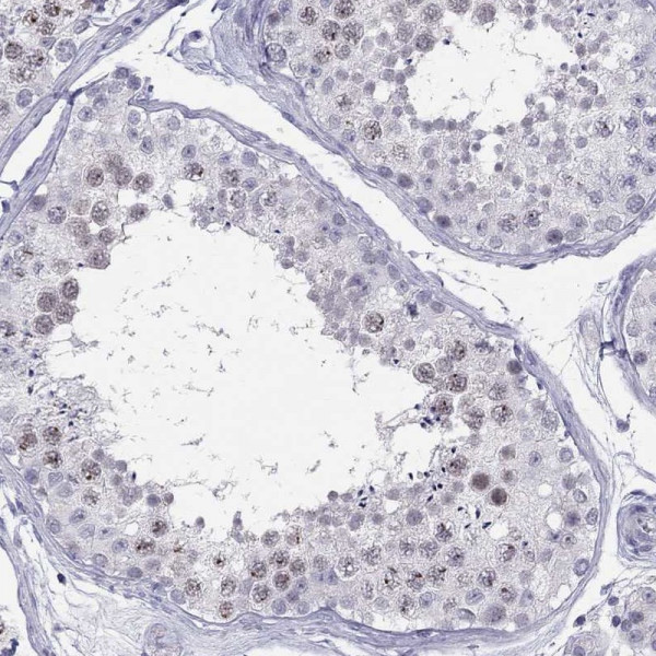 Anti-C11orf63