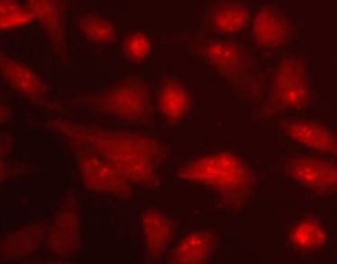 Anti-beta Arrestin 1