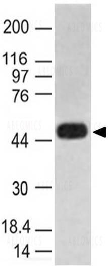 Anti-Caspase-1 (Clone: ABM1B93)