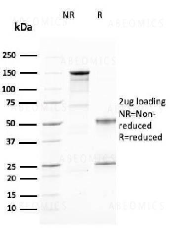 Anti-CD25 / IL2RA (Activated Lymphocyte Marker) Monoclonal Antibody (Clone: IL2RA/2394)