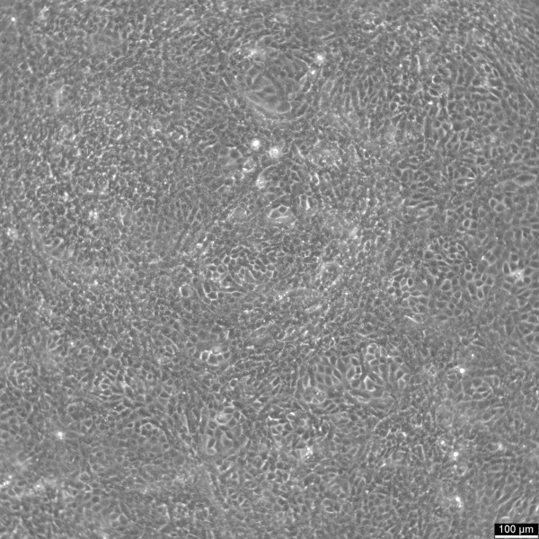 TM3 Cells