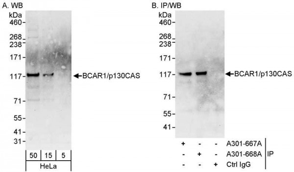 Anti-BCAR1/p130CAS