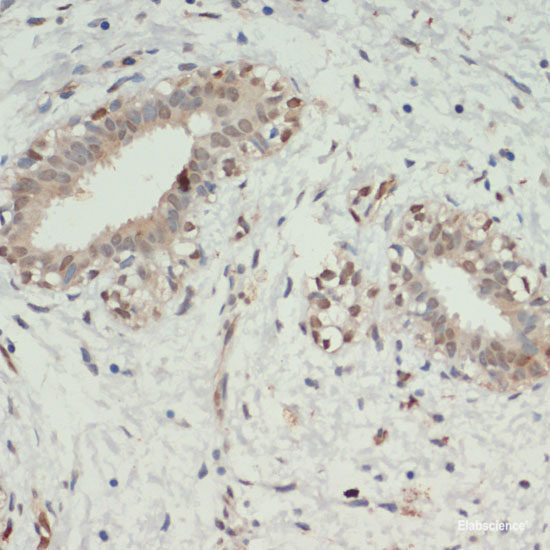 Anti-KDM6A
