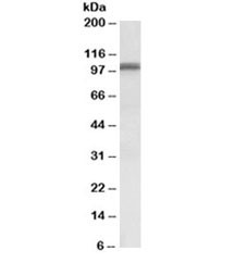 Anti-GLUR1