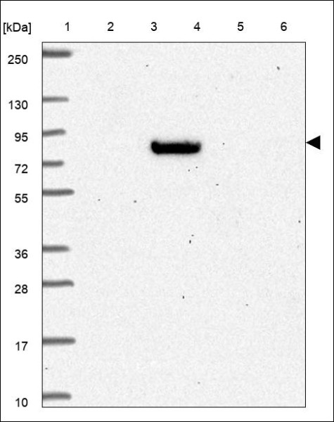 Anti-ABCB7