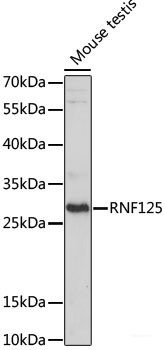 Anti-RNF125