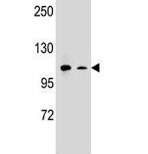 Anti-CD11b