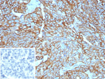 Anti-MUC16 / CA125, clone CA125/8893