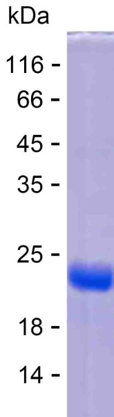 Recombinant Human SH3BP4 Protein